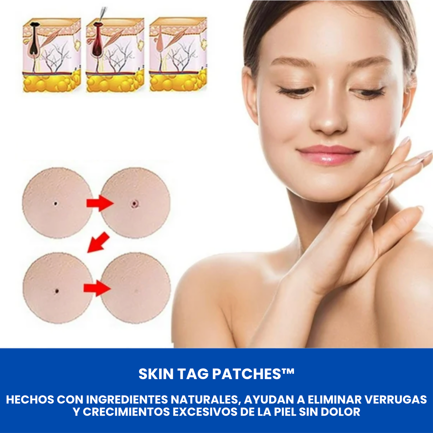 Skin Tag Patches™ Parches para Eliminar Verrugas en Casa